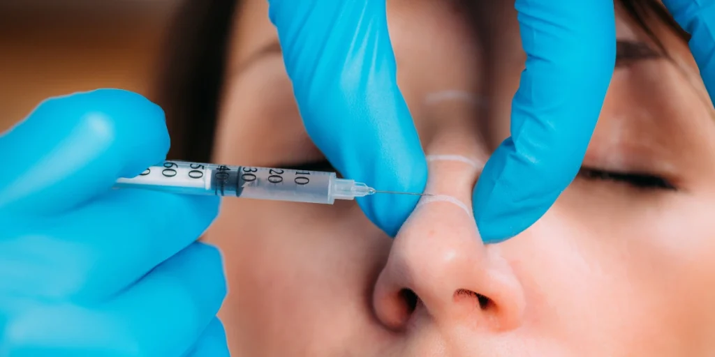 nose thread lift​
