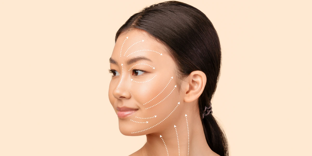 Thread Lift Treatment Malaysia: 4 Reasons to Consider Luna Q