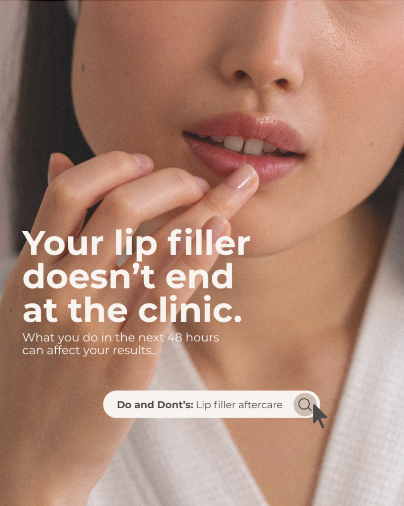 Your Lip Filler Doesn't End At The Clinic